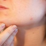 खराश की समस्या