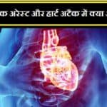 कार्डियक अरेस्ट