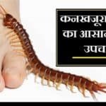 कनखजूरा काटने का उपचार