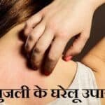 खुजली के घरेलू उपाय