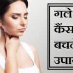 गले का कैंसर बचाव
