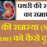 पथरी की समस्या (Stone problem) को कैसे दूर करें
