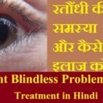 रतौंधी की समस्या और घरेलू इलाज