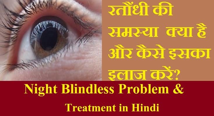 रतौंधी की समस्या और घरेलू इलाज