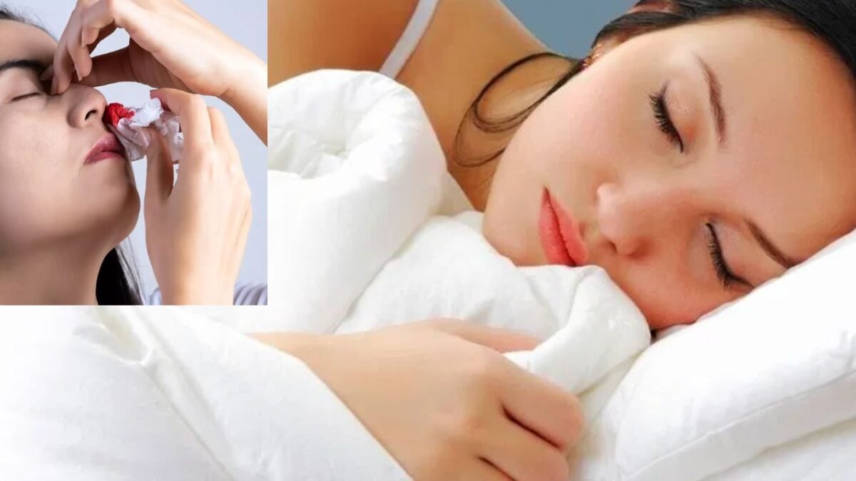 नाक से खून आना