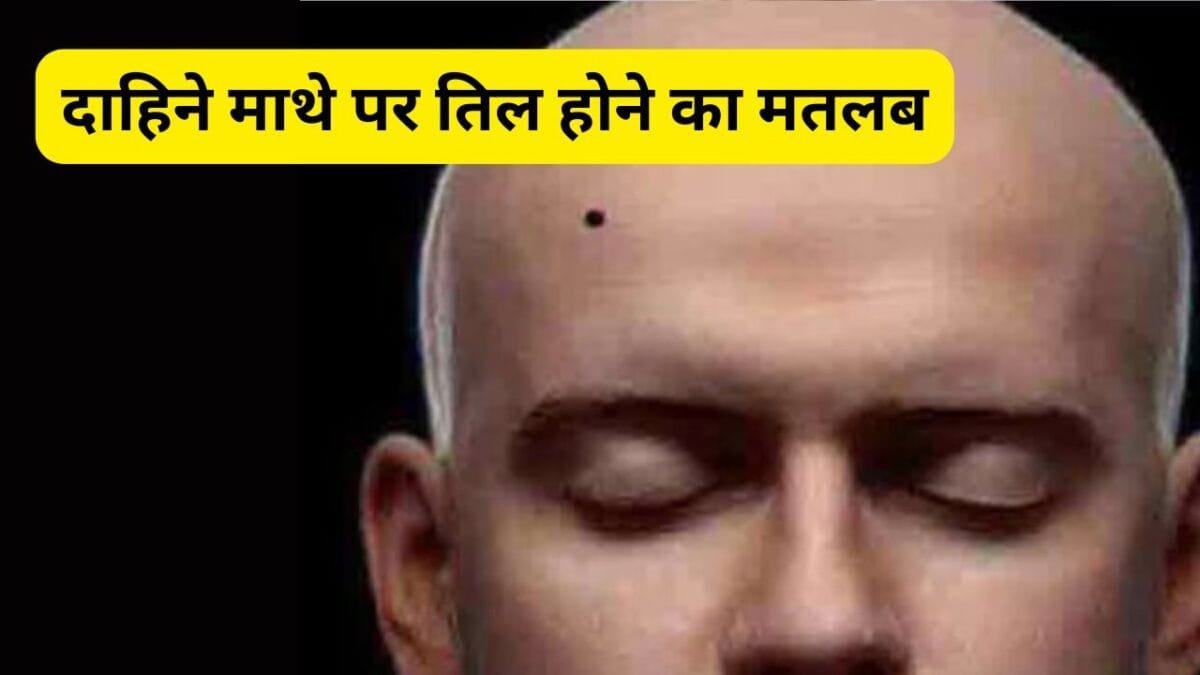 पुरुष के दाहिने माथे पर तिल होना